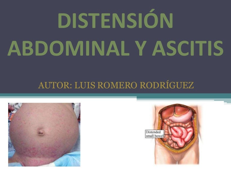 Desgarro muscular abdominal embarazo